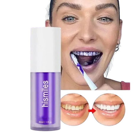 Dent Blanche et Brillante Instantanément !