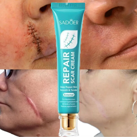 Crème Réparatrice Intense – Efface Cicatrices et Imperfections.